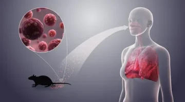 ماهو فيروس هانتا وكيف ينتقل للإنسان